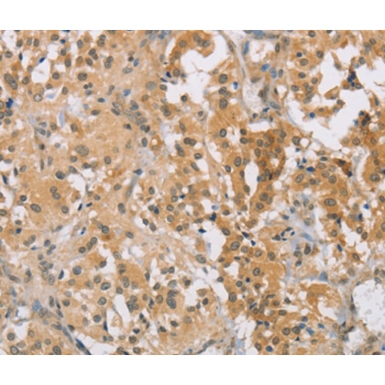 Immunohistochemistry - CENPF Antibody from Signalway Antibody (37483) - Antibodies.com