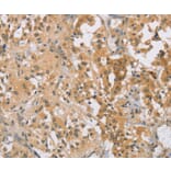 Immunohistochemistry - CENPF Antibody from Signalway Antibody (37483) - Antibodies.com