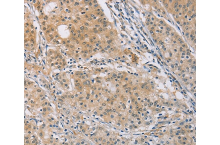 Immunohistochemistry - CENPF Antibody from Signalway Antibody (37483) - Antibodies.com
