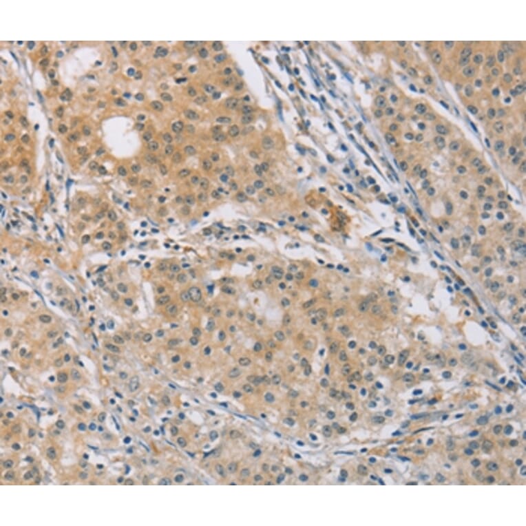 Immunohistochemistry - CENPF Antibody from Signalway Antibody (37483) - Antibodies.com