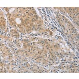 Immunohistochemistry - CENPF Antibody from Signalway Antibody (37483) - Antibodies.com