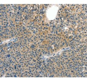 Immunohistochemistry - CRLF2 Antibody from Signalway Antibody (37496) - Antibodies.com