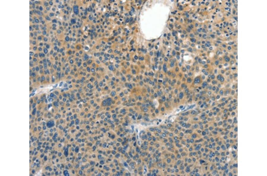 Immunohistochemistry - CRLF2 Antibody from Signalway Antibody (37496) - Antibodies.com