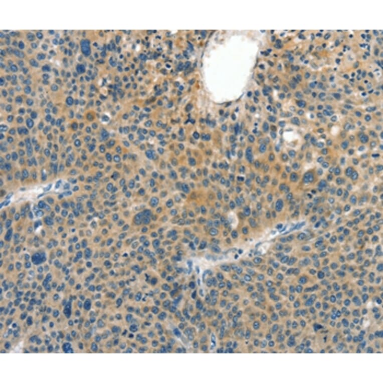 Immunohistochemistry - CRLF2 Antibody from Signalway Antibody (37496) - Antibodies.com