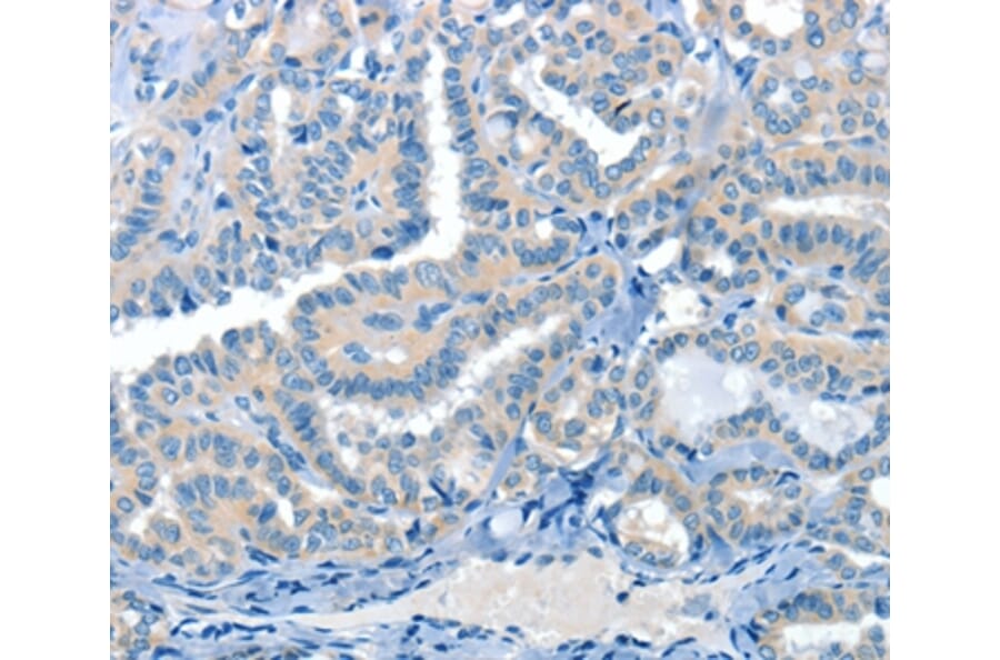 Immunohistochemistry - CRLF2 Antibody from Signalway Antibody (37496) - Antibodies.com