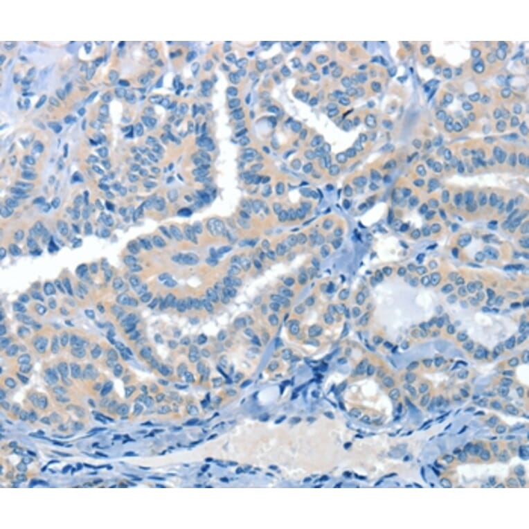 Immunohistochemistry - CRLF2 Antibody from Signalway Antibody (37496) - Antibodies.com