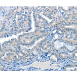 Immunohistochemistry - CRLF2 Antibody from Signalway Antibody (37496) - Antibodies.com