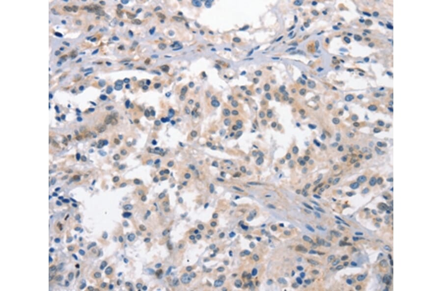 Immunohistochemistry - CRHR1 Antibody from Signalway Antibody (37503) - Antibodies.com