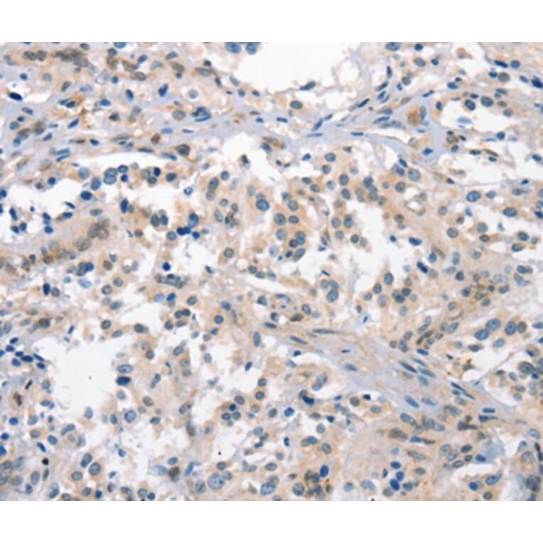 Immunohistochemistry - CRHR1 Antibody from Signalway Antibody (37503) - Antibodies.com