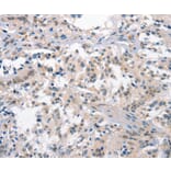 Immunohistochemistry - CRHR1 Antibody from Signalway Antibody (37503) - Antibodies.com