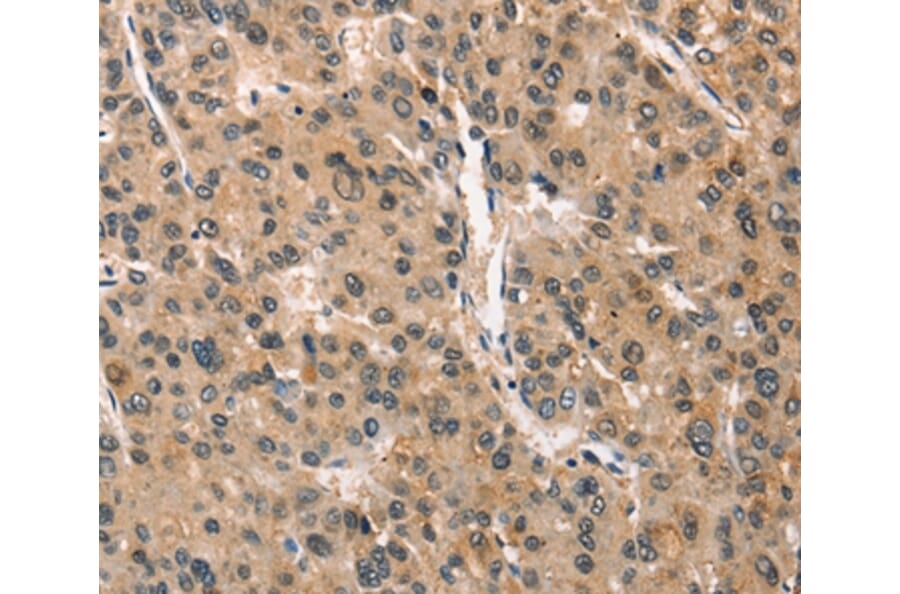Immunohistochemistry - CRIM1 Antibody from Signalway Antibody (37505) - Antibodies.com