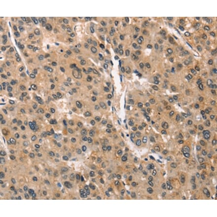 Immunohistochemistry - CRIM1 Antibody from Signalway Antibody (37505) - Antibodies.com