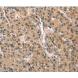 Immunohistochemistry - CRIM1 Antibody from Signalway Antibody (37505) - Antibodies.com