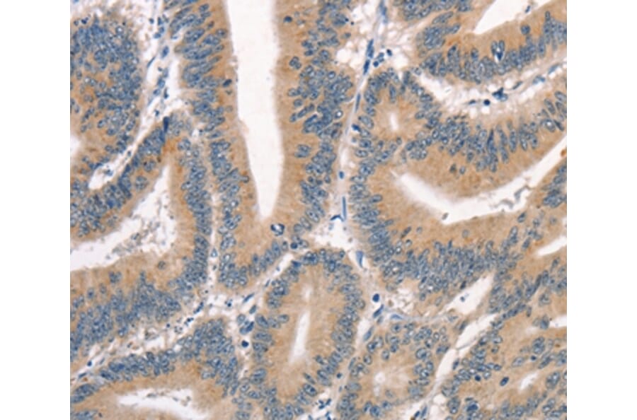 Immunohistochemistry - CRIM1 Antibody from Signalway Antibody (37505) - Antibodies.com