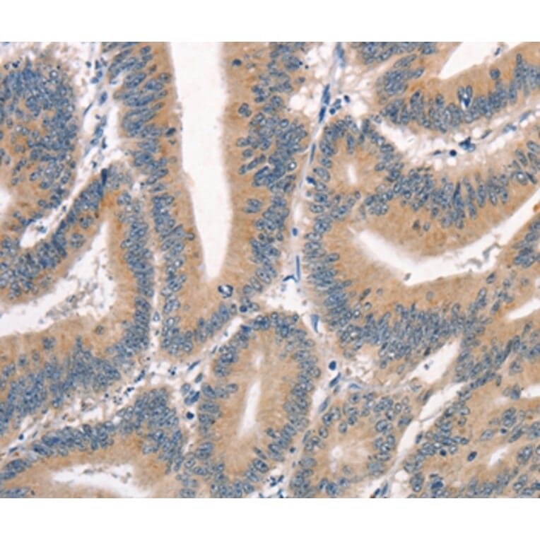 Immunohistochemistry - CRIM1 Antibody from Signalway Antibody (37505) - Antibodies.com