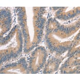 Immunohistochemistry - CRIM1 Antibody from Signalway Antibody (37505) - Antibodies.com