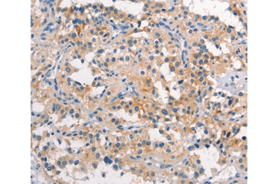 Immunohistochemistry - TDGF1 Antibody from Signalway Antibody (37506) - Antibodies.com