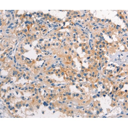 Immunohistochemistry - TDGF1 Antibody from Signalway Antibody (37506) - Antibodies.com