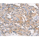 Immunohistochemistry - TDGF1 Antibody from Signalway Antibody (37506) - Antibodies.com