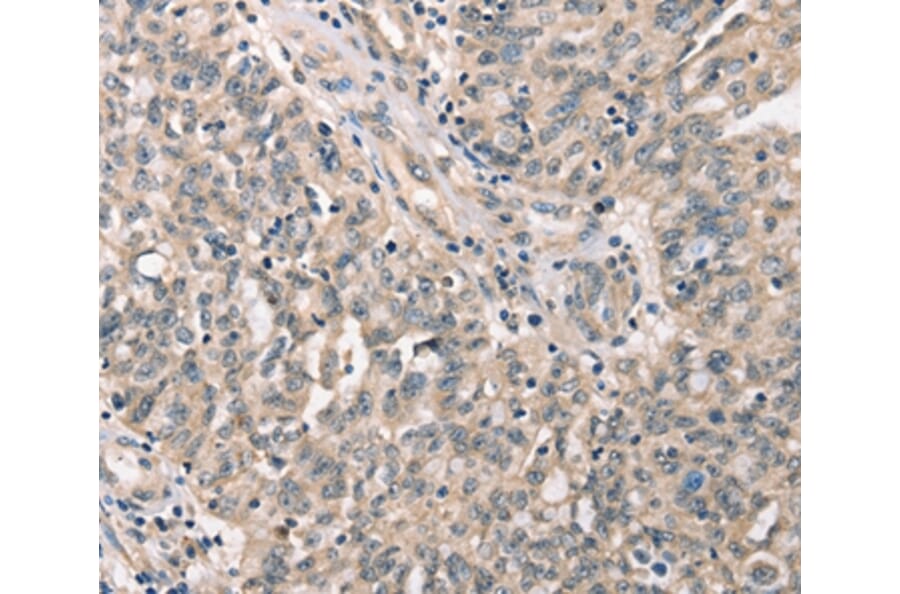 Immunohistochemistry - CDK12 Antibody from Signalway Antibody (37508) - Antibodies.com