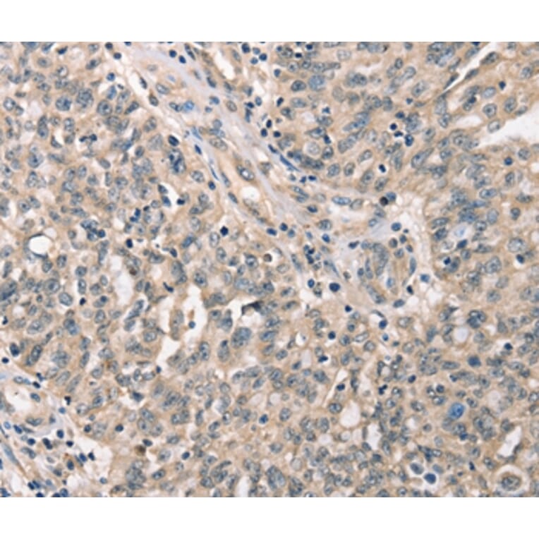 Immunohistochemistry - CDK12 Antibody from Signalway Antibody (37508) - Antibodies.com