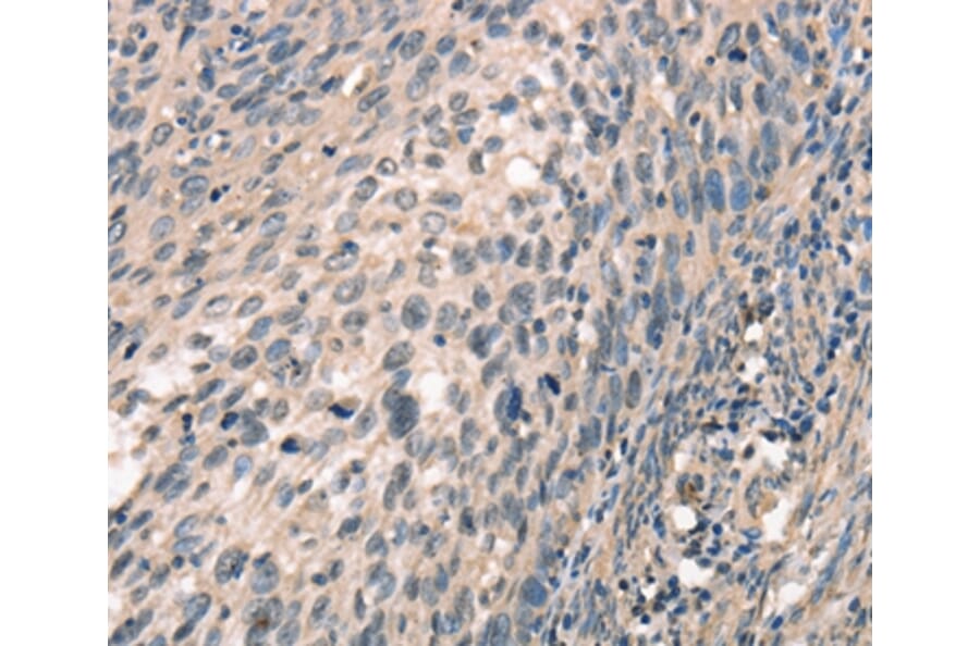Immunohistochemistry - CDK12 Antibody from Signalway Antibody (37508) - Antibodies.com