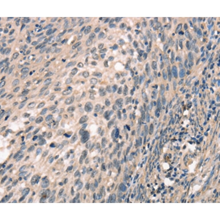 Immunohistochemistry - CDK12 Antibody from Signalway Antibody (37508) - Antibodies.com