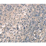 Immunohistochemistry - CDK12 Antibody from Signalway Antibody (37508) - Antibodies.com