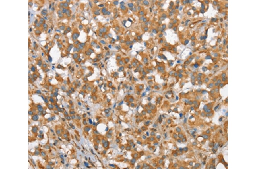 Immunohistochemistry - CSMD1 Antibody from Signalway Antibody (37511) - Antibodies.com