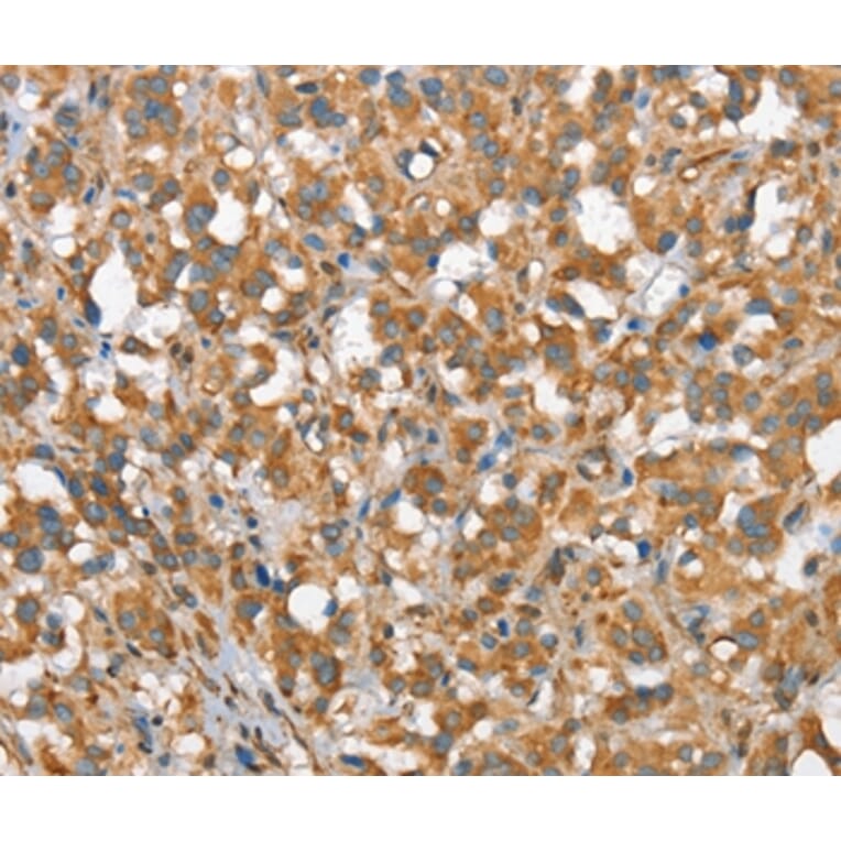 Immunohistochemistry - CSMD1 Antibody from Signalway Antibody (37511) - Antibodies.com