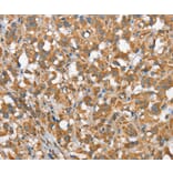 Immunohistochemistry - CSMD1 Antibody from Signalway Antibody (37511) - Antibodies.com