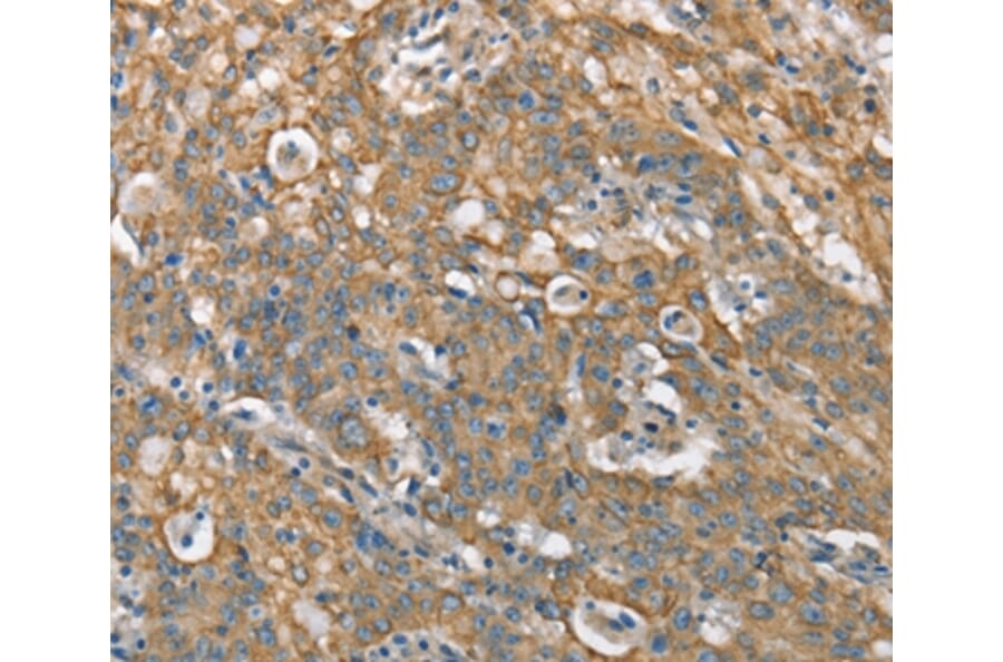 Immunohistochemistry - CSMD1 Antibody from Signalway Antibody (37511) - Antibodies.com