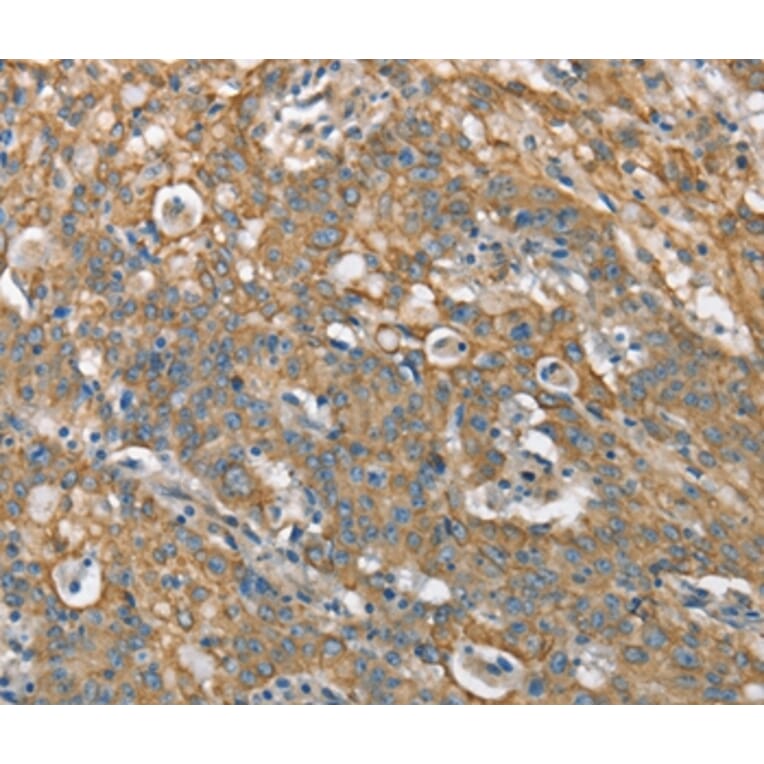Immunohistochemistry - CSMD1 Antibody from Signalway Antibody (37511) - Antibodies.com