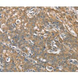 Immunohistochemistry - CSMD1 Antibody from Signalway Antibody (37511) - Antibodies.com