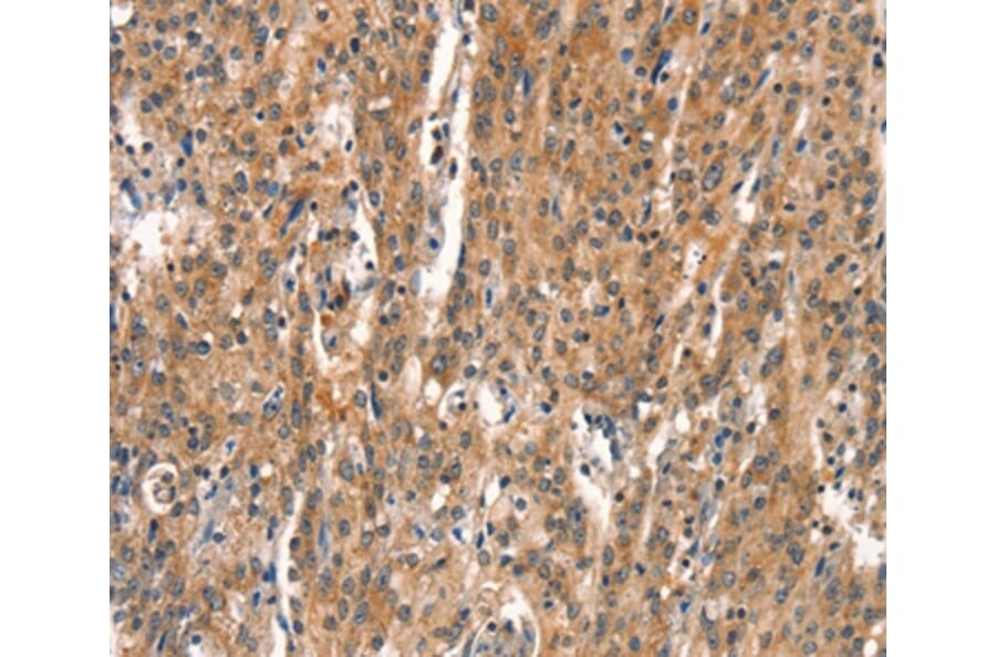 Immunohistochemistry - DEAF1 Antibody from Signalway Antibody (37523) - Antibodies.com