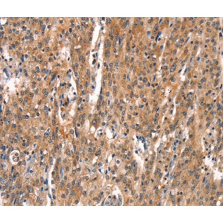 Immunohistochemistry - DEAF1 Antibody from Signalway Antibody (37523) - Antibodies.com