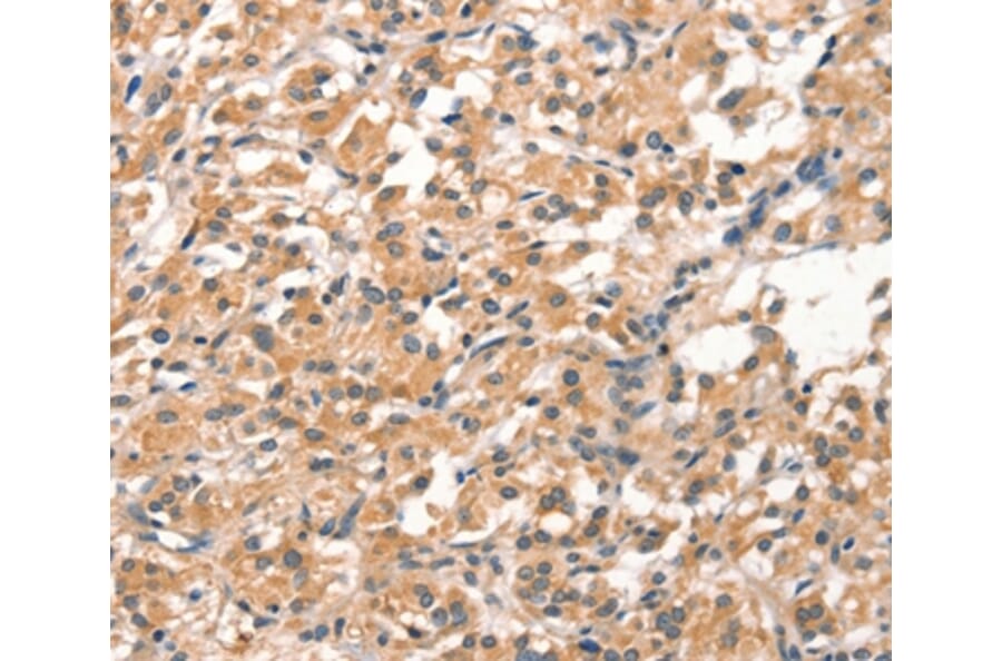 Immunohistochemistry - DEAF1 Antibody from Signalway Antibody (37523) - Antibodies.com