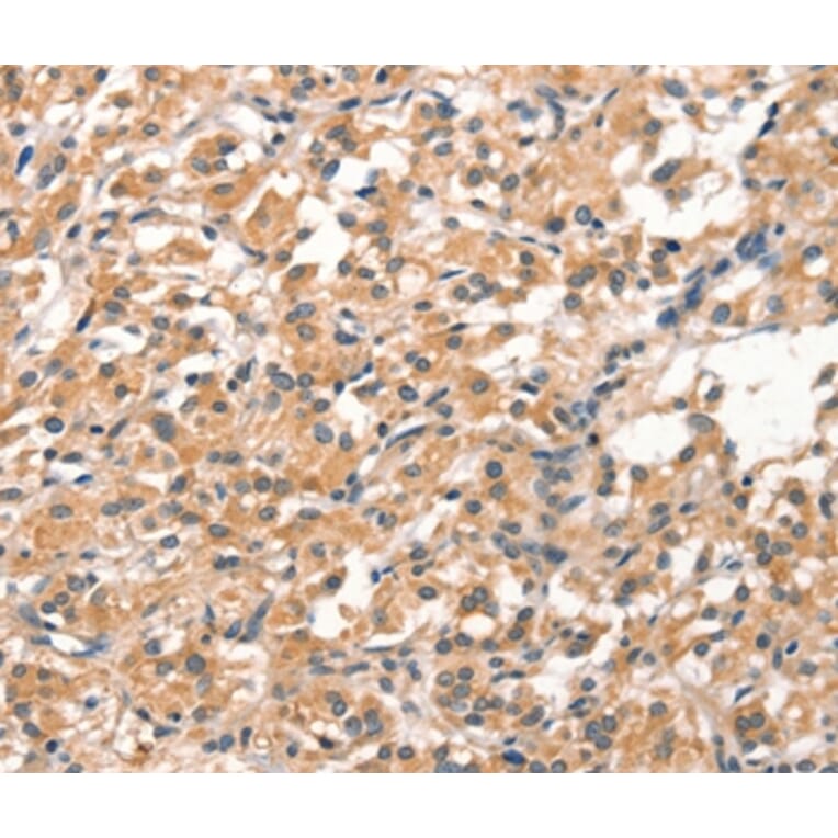 Immunohistochemistry - DEAF1 Antibody from Signalway Antibody (37523) - Antibodies.com