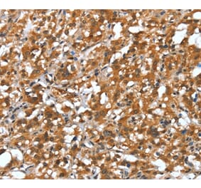 Immunohistochemistry - DEFA4 Antibody from Signalway Antibody (37526) - Antibodies.com
