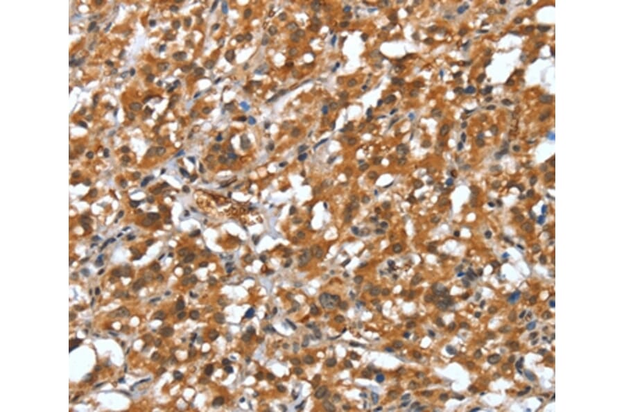 Immunohistochemistry - DEFA4 Antibody from Signalway Antibody (37526) - Antibodies.com