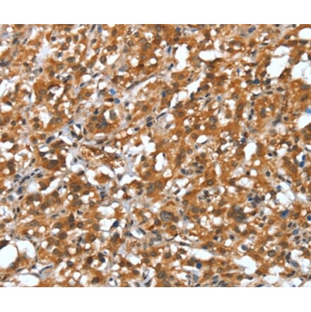 Immunohistochemistry - DEFA4 Antibody from Signalway Antibody (37526) - Antibodies.com