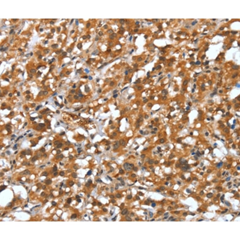 Immunohistochemistry - DEFA4 Antibody from Signalway Antibody (37526) - Antibodies.com