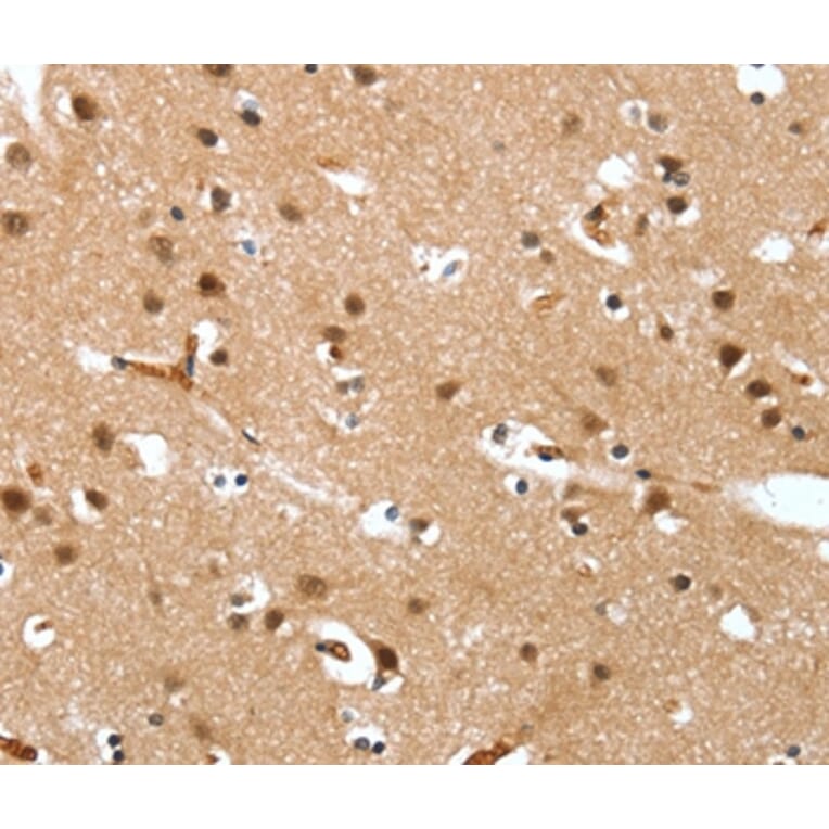 Immunohistochemistry - DEFA4 Antibody from Signalway Antibody (37526) - Antibodies.com