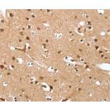 Immunohistochemistry - DEFA4 Antibody from Signalway Antibody (37526) - Antibodies.com