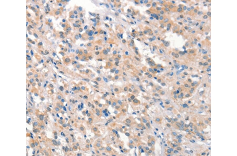 Immunohistochemistry - KCNB1 Antibody from Signalway Antibody (37539) - Antibodies.com