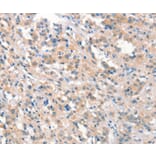 Immunohistochemistry - KCNB1 Antibody from Signalway Antibody (37539) - Antibodies.com