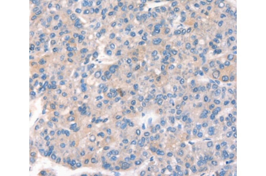 Immunohistochemistry - KCNB1 Antibody from Signalway Antibody (37539) - Antibodies.com