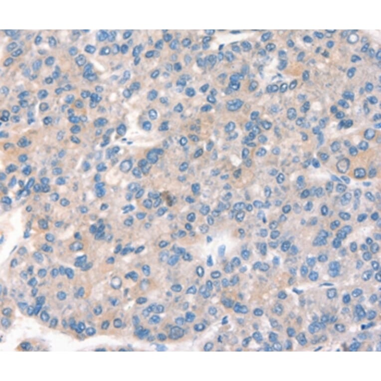 Immunohistochemistry - KCNB1 Antibody from Signalway Antibody (37539) - Antibodies.com