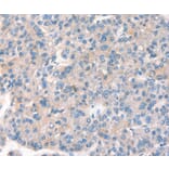 Immunohistochemistry - KCNB1 Antibody from Signalway Antibody (37539) - Antibodies.com