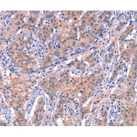Immunohistochemistry - EP300 Antibody from Signalway Antibody (37550) - Antibodies.com